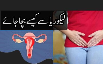 Likoria Se Shifa Ka Taweez | Likoria Khatam Karne Ka Ilaj