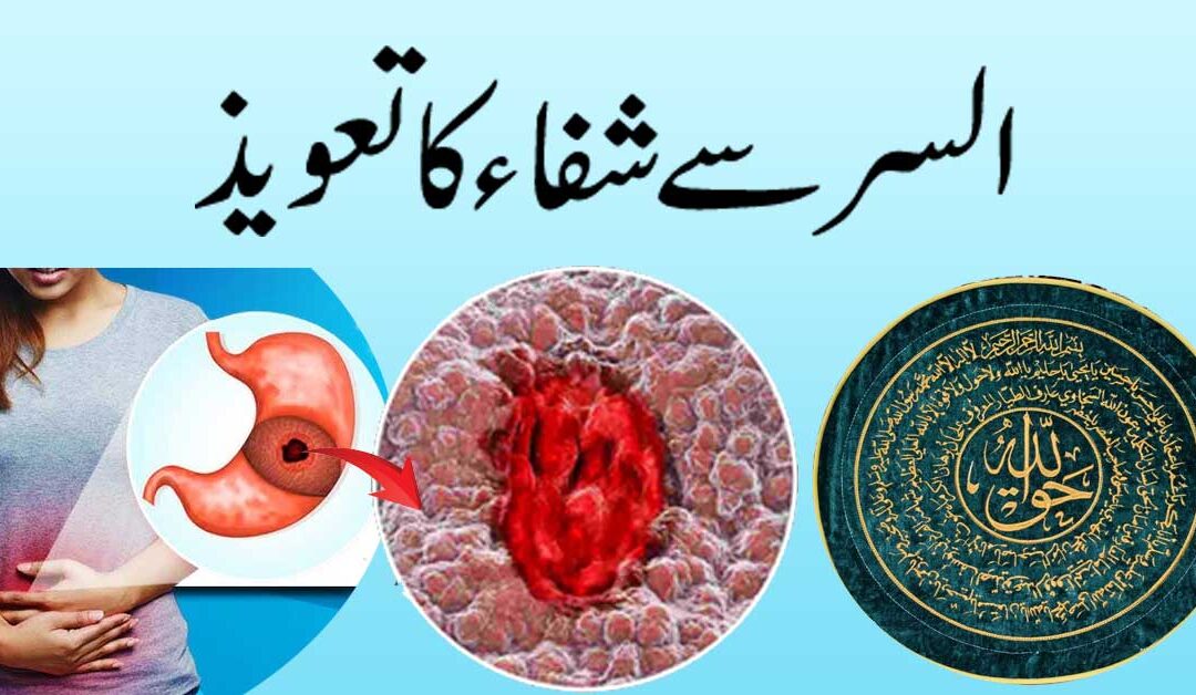 Ulcer Se Shifa Ka Powerful Taweez