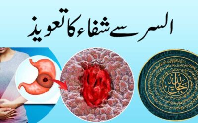 Ulcer Se Shifa Ka Powerful Taweez