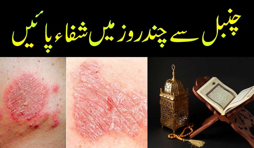 Chambal Ki Bimari Se Shifa Ka Taweez