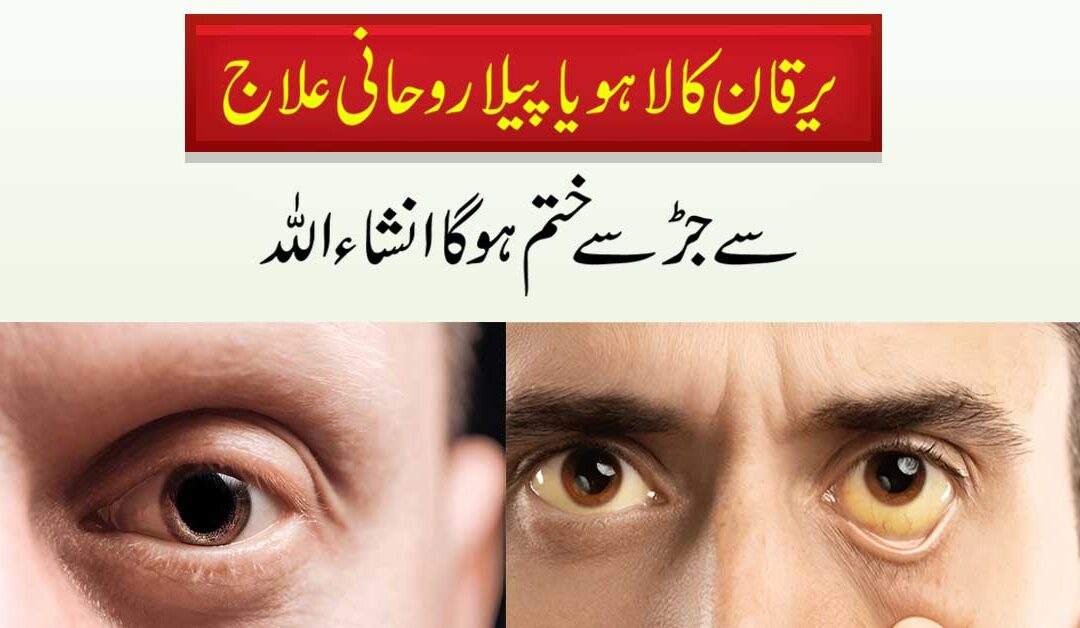 Kale Aur Peele Yarkan Ka Ilaj