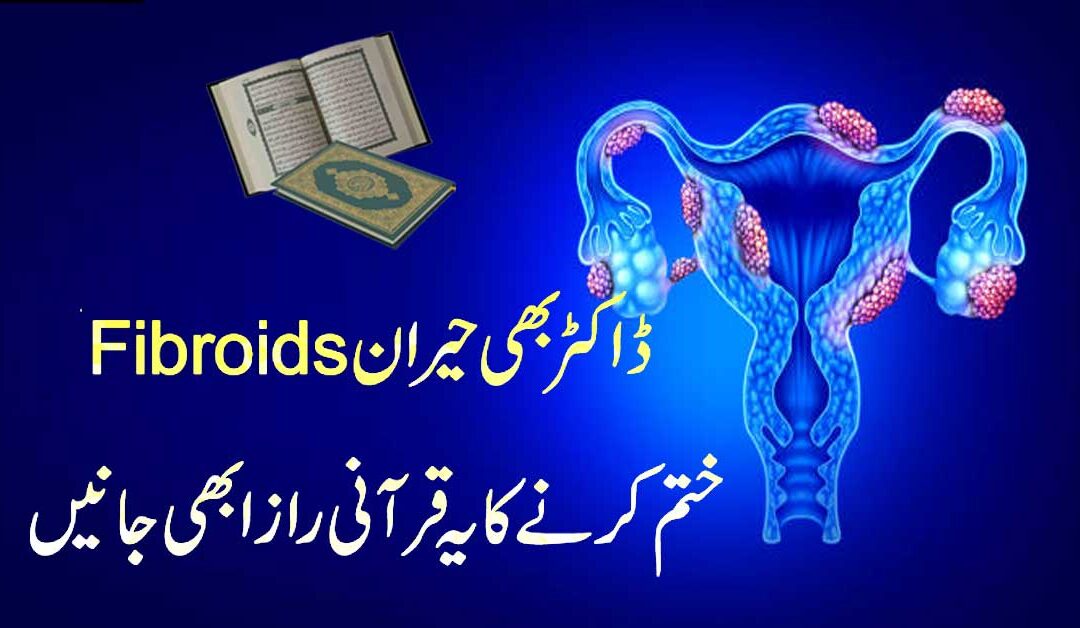 Fibroids Khatam Karne Ka Qurani Raaz