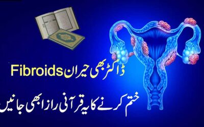 Fibroids Khatam Karne Ka Qurani Raaz