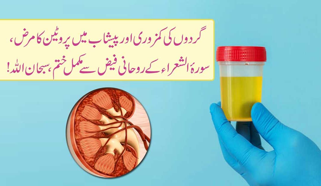 Peshab Mein Protein Aana Ka Rohani Ilaj