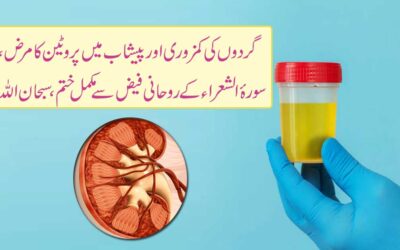 Peshab Mein Protein Aana Ka Rohani Ilaj