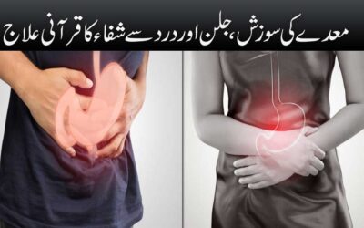 Best Treatment For Stomach Inflammation