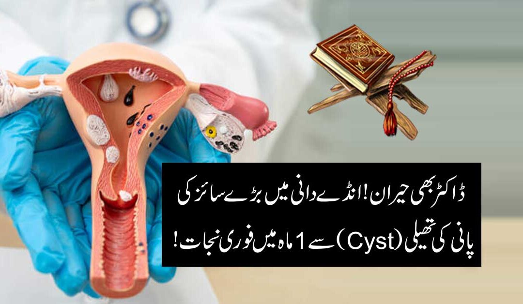 Ovarian Cyst Taweez