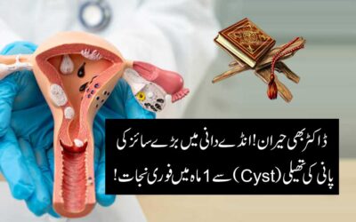 Ovarian Cyst Taweez